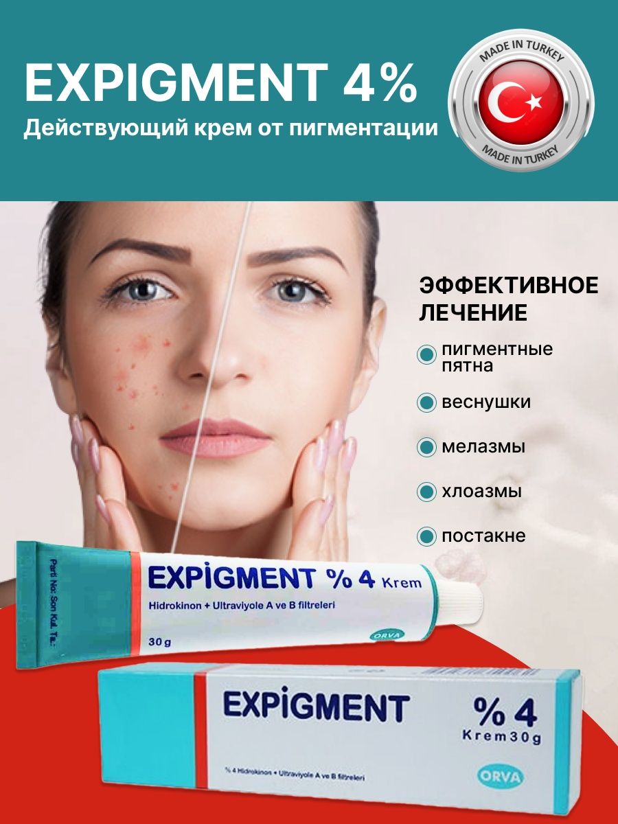 Крем expigment 4 инструкция на русском. Expigment 4. Мазь expigment 4. Турецкий отбеливающий крем expigment. Постпигментация expigment 4.