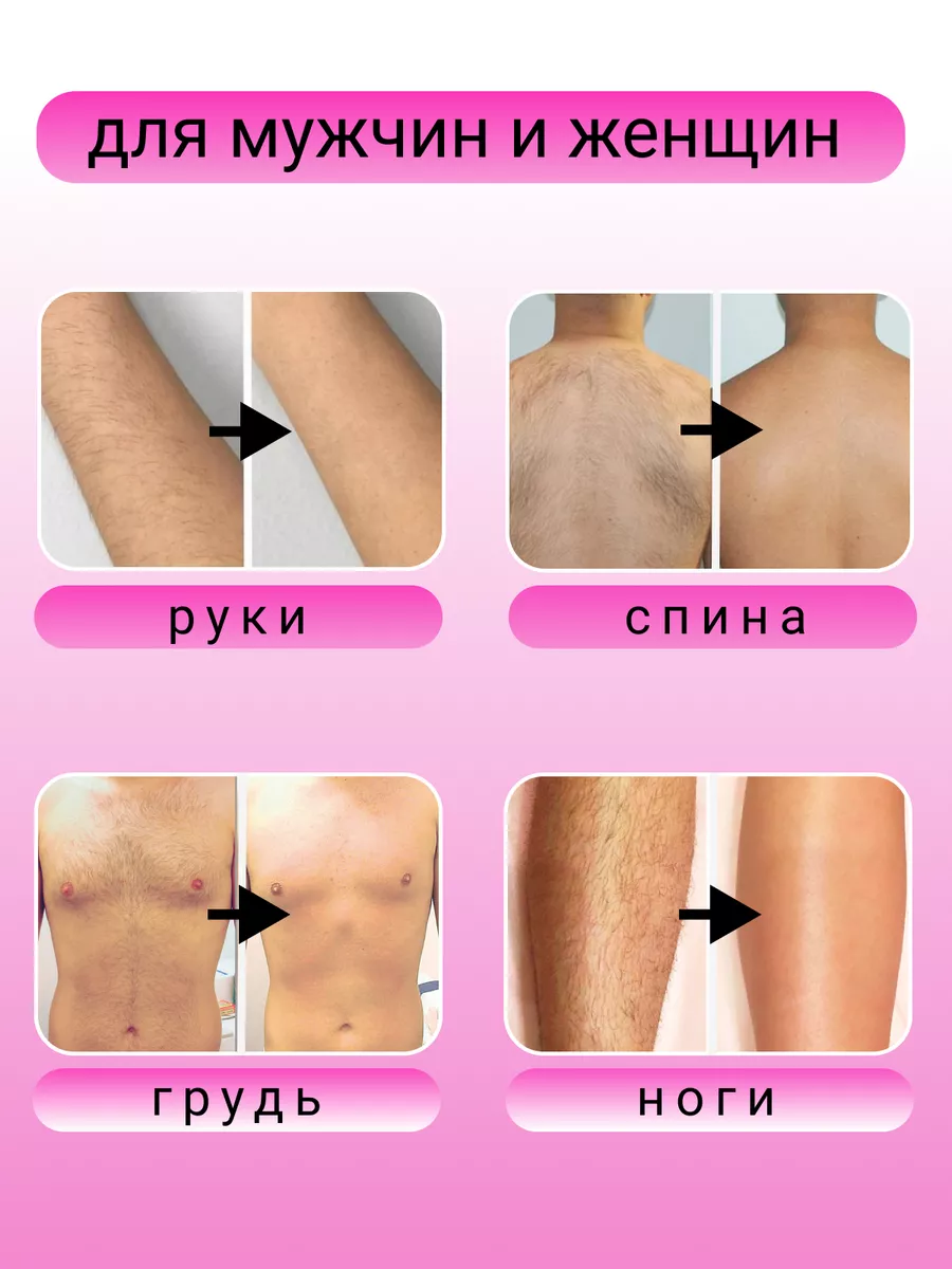 Стекло для депиляции. Депилятор ластик. Ластик для удаления волос. Стекло для депиляции. Депилятор ластик.