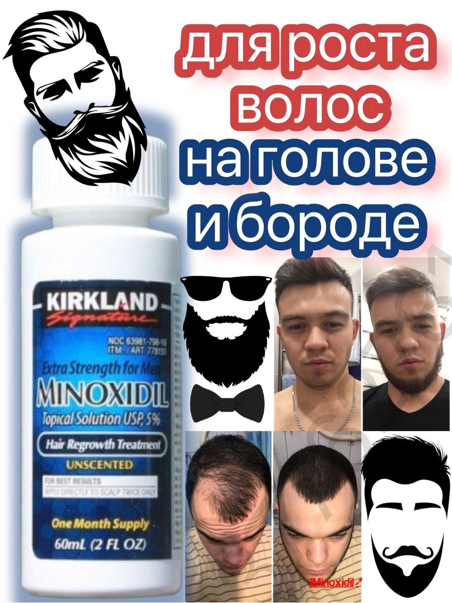 Миноксидил 5 для бороды. Minoxidil Kirkland миноксидил 5% 60 мл. Kirkland Minoxidil 60 ml. Kirkland Minoxidil 5%, лосьон миноксидил 5%. Миноксидил Киркланд Minoxidil Kirkland 5%.