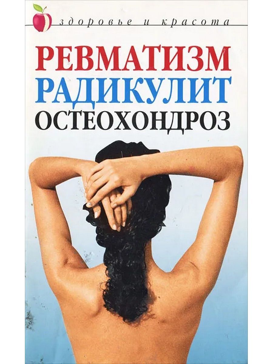 Радикулит 5 букв. Для ревматизм радикулит. Ревматизм книга. Радикулопатия (радикулиты). Мрт позвоночника остеохондроз.