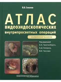 Атлас видеоэндоскопических внутрипросветных операций в к