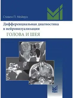 Дифференциальная диагностика в нейровизуализации. Голова