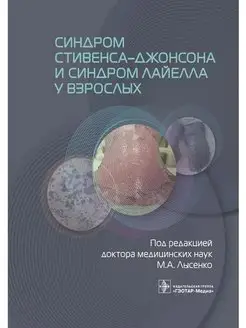 Синдром Стивенса-Джонсона и синдром Лайелла у взрослых