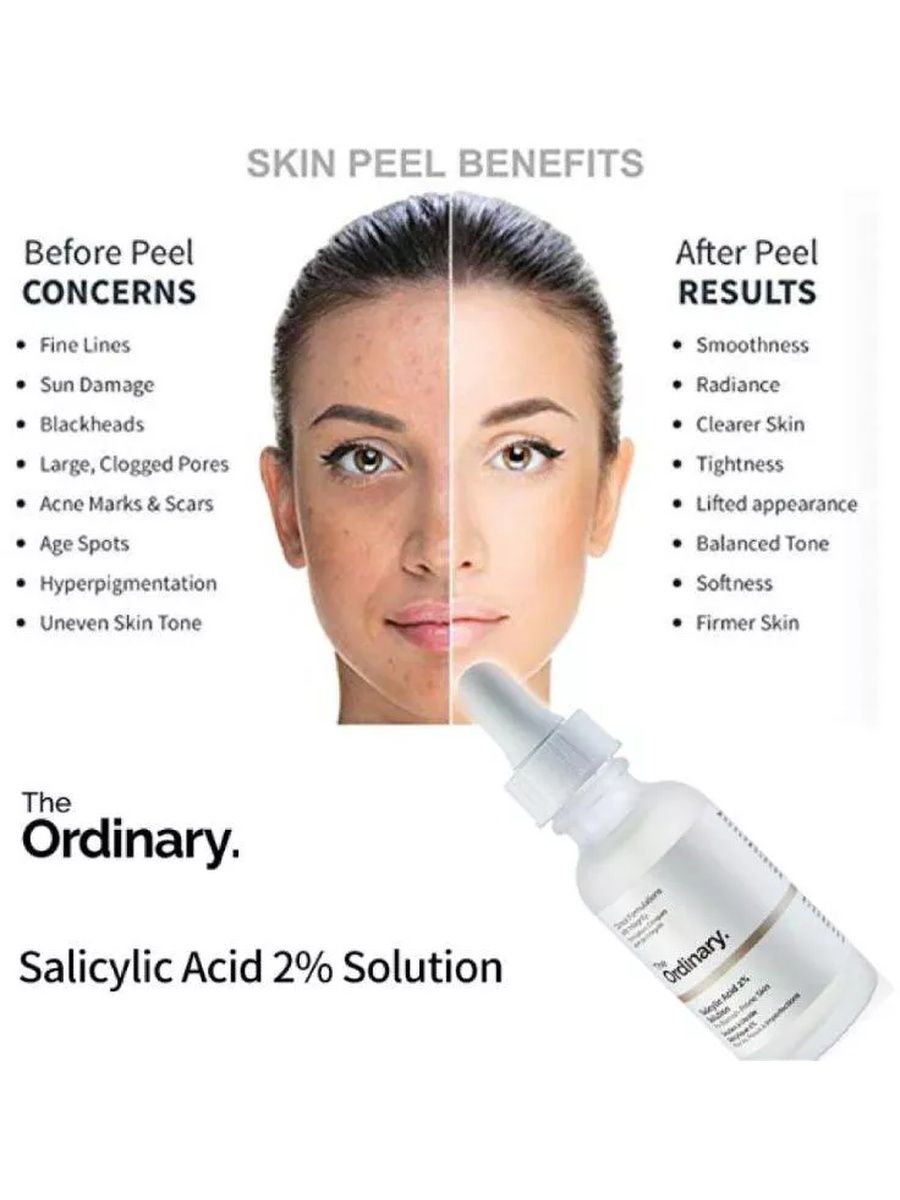 Кислоты для кожи лица. The ordinary Salicylic acid. The ordinary Salicylic acid Serum. The ordinary Salicylic acid New. Заказать ordinary сыворотка от пигментации для лица и пилинг.