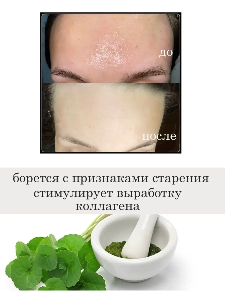 Neulii niacinamide 10. Neulii niacinamide 10