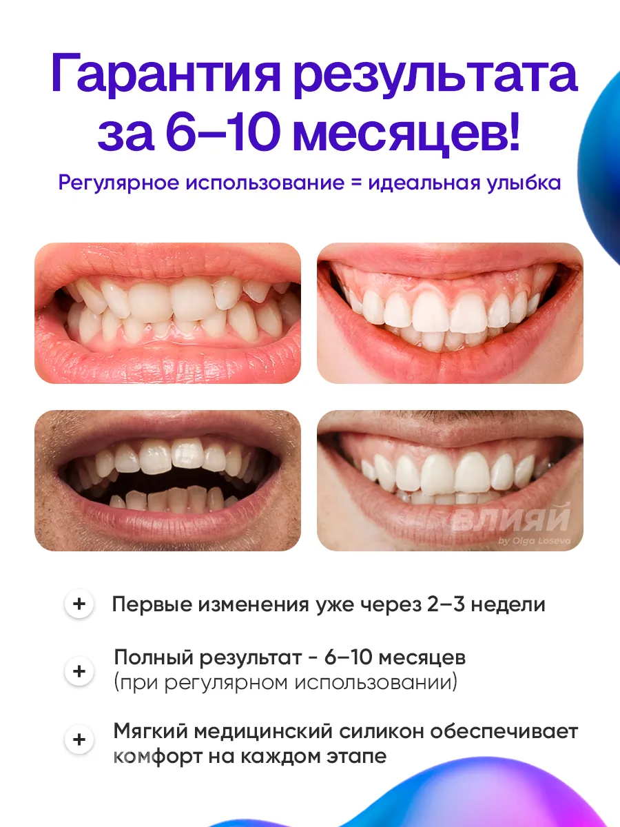 Трейнеры для выравнивания зубов у взрослых и детей