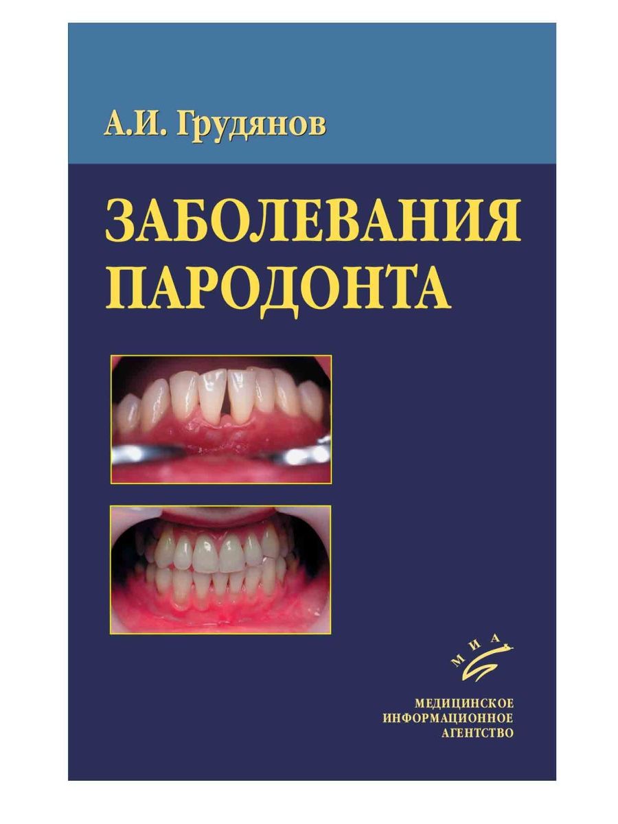 Диагностика заболеваний пародонта. Пародонтология методичка. Другие заболевания пародонта это.