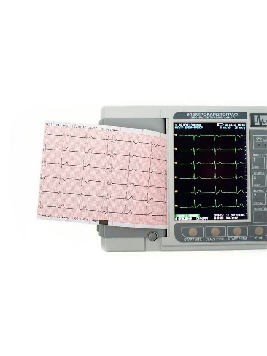 Экг в москве. Электрокардиограф эк12т-01-р-д/141. Электрокардиограф эк12т-01-