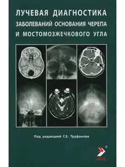 Лучевая диагностика заболеваний оснований черепа и мостм